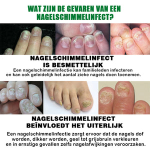 Nagelverzorging met gember