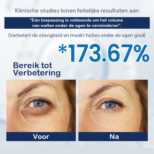 Crème tegen wallen - 💖Koop 1, krijg 1 gratis (2 stuks)💖