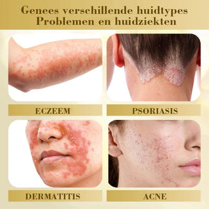 Condense Mellifera Venom Huidherstellende Crème