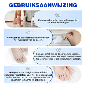 Nagel Reparatie Stickers