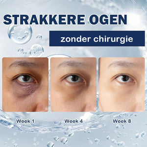 Crème tegen wallen - 💖Koop 1, krijg 1 gratis (2 stuks)💖