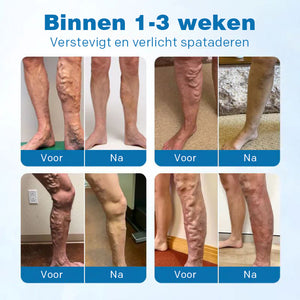 VeinGuard Kruidenspray