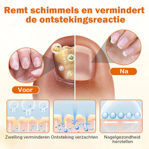 Geavanceerde nagelreparatiespray