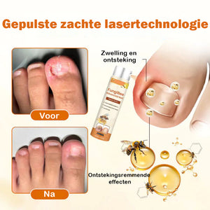 Geavanceerde nagelreparatiespray