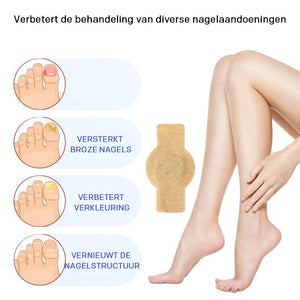 Nagel Reparatie Stickers