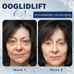 Crème tegen wallen - 💖Koop 1, krijg 1 gratis (2 stuks)💖