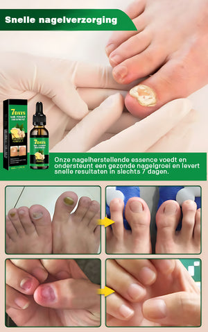 Nagelverzorging met gember