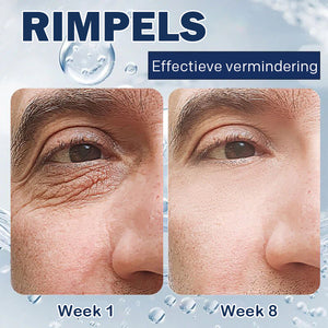 Crème tegen wallen - 💖Koop 1, krijg 1 gratis (2 stuks)💖