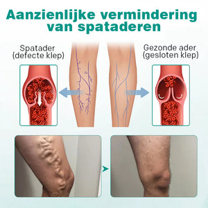 Spataderen pleister