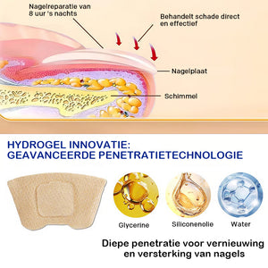 Nagel Reparatie Stickers