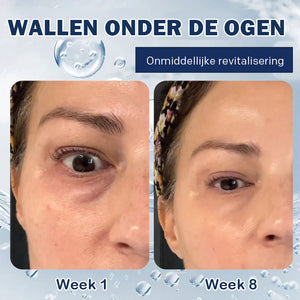 Crème tegen wallen - 💖Koop 1, krijg 1 gratis (2 stuks)💖