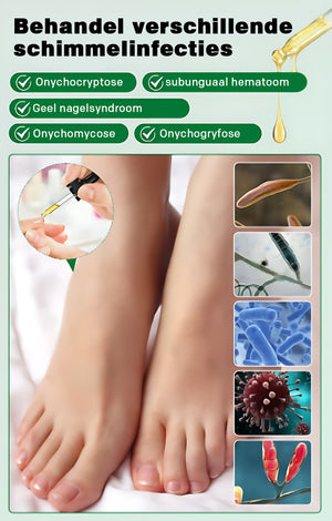 Nagelverzorging met gember