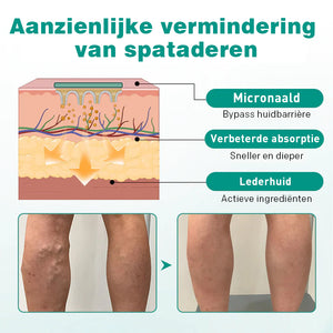 Spataderen pleister