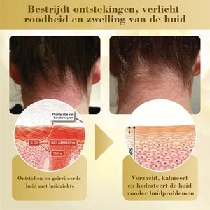 Condense Mellifera Venom Huidherstellende Crème