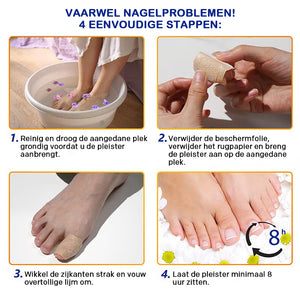 Nagel Reparatie Stickers