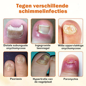 Geavanceerde nagelreparatiespray