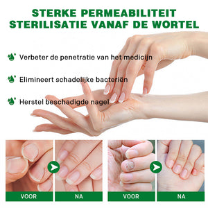 Nagelverzorging met gember