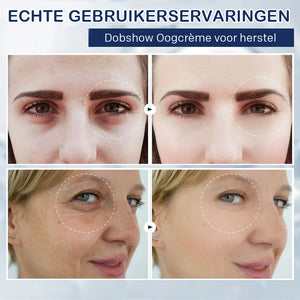 Crème tegen wallen - 💖Koop 1, krijg 1 gratis (2 stuks)💖