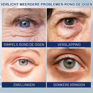 Crème tegen wallen - 💖Koop 1, krijg 1 gratis (2 stuks)💖